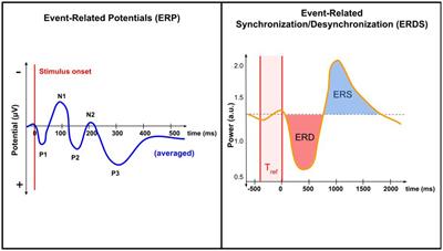 In search of a composite biomarker for chronic pain by way of EEG and machine learning: where do we currently stand?